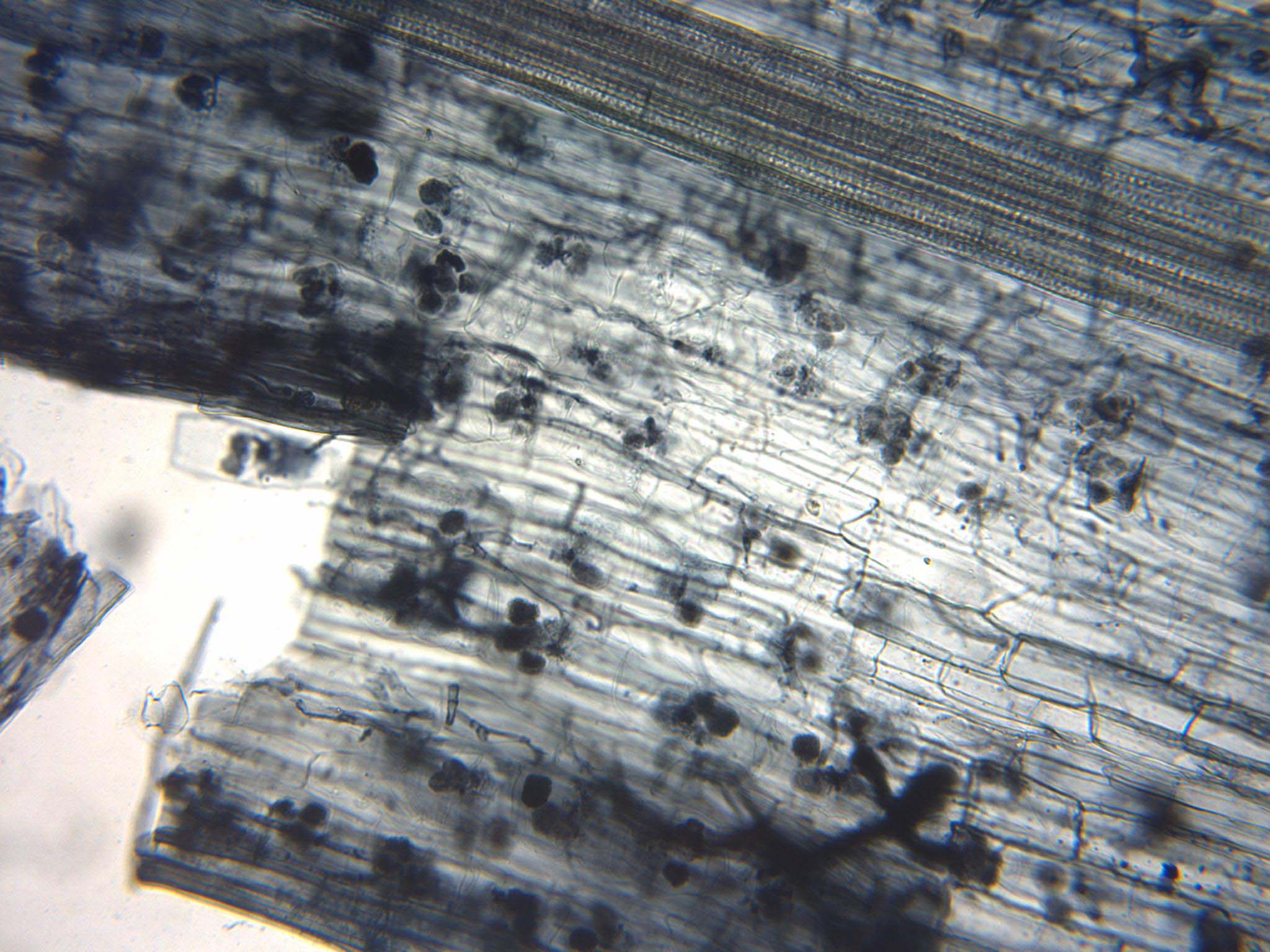 Microscope view of arbuscular mycorrhizae